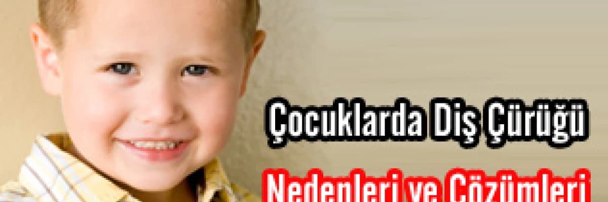 Çocuklarda Diş Çürüğü Nedenleri ve Çözümleri