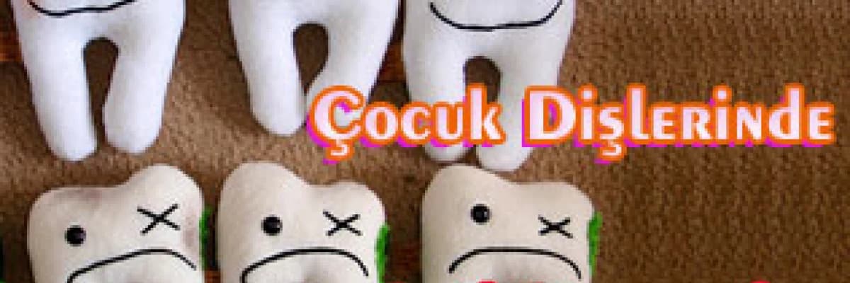 Çocuk dişlerinde acil durumlar