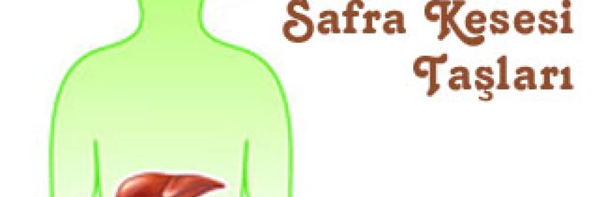 Safra kesesi taşları