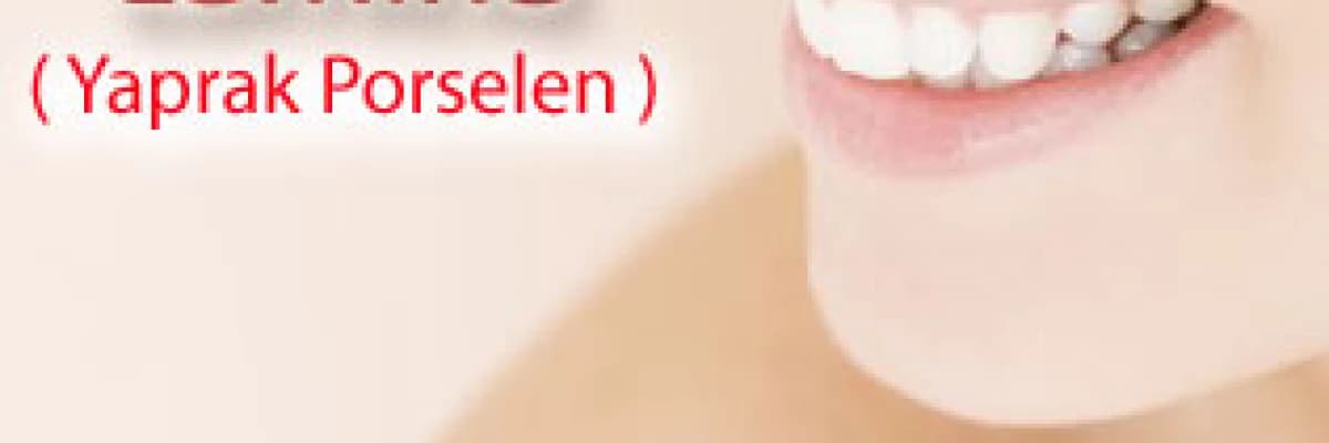 Lamina ( Yaprak Porselen )