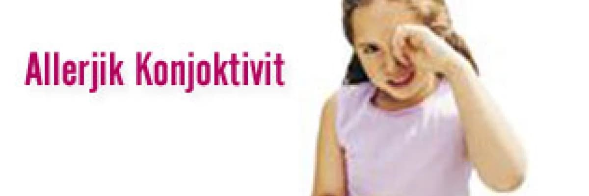 Allerjik konjoktivit