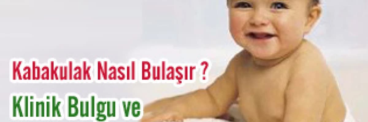 Kabakulak Nasıl Bulaşır ? Klinik Bulgu ve Yan Etkileri
