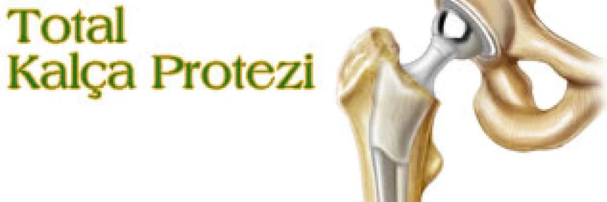 Total kalça protezi uygulaması