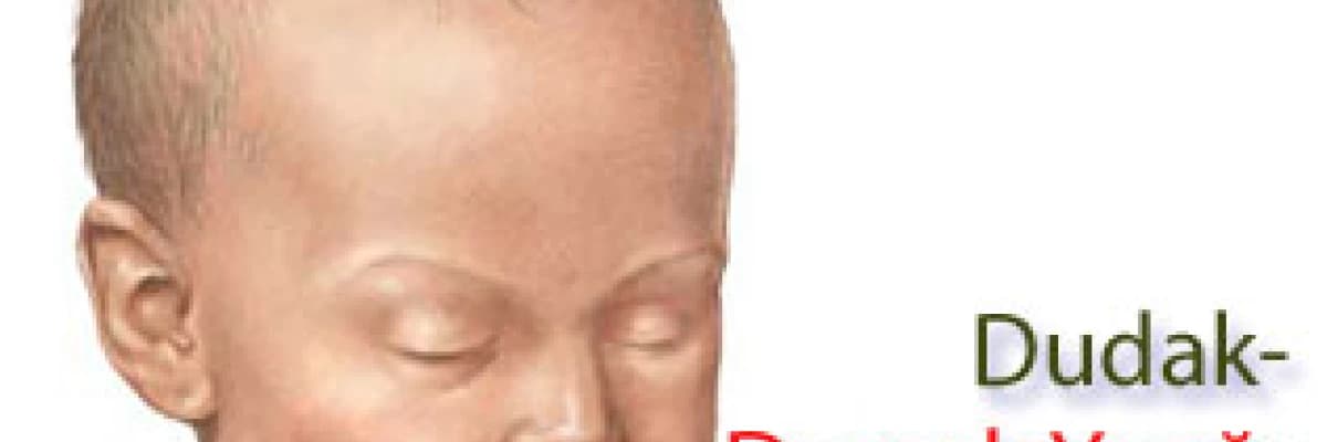 Dudak-Damak Yarığı ile Doğmuş Çocuklarda