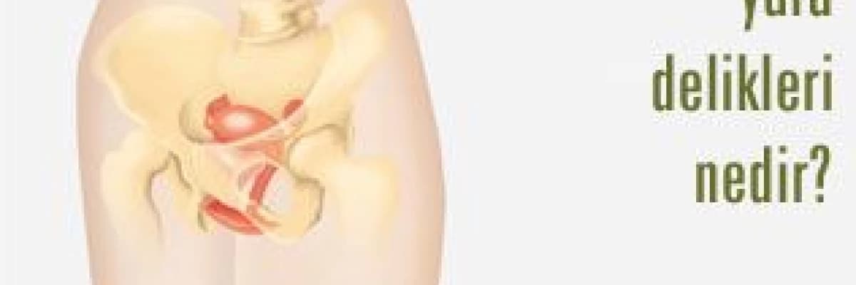 Rahimde yara delikleri nedir?