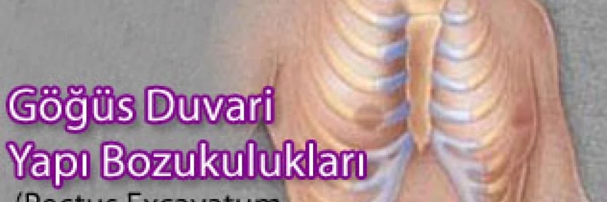 Göğüs duvarı yapı bozuklukları (pectus excavatum - pectus carinatum)