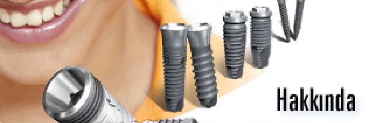 Diş implantları hakkında merak ettikleriniz!