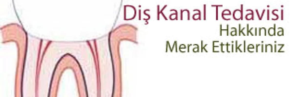 Diş kanal tedavisi hakkında merak ettikleriniz