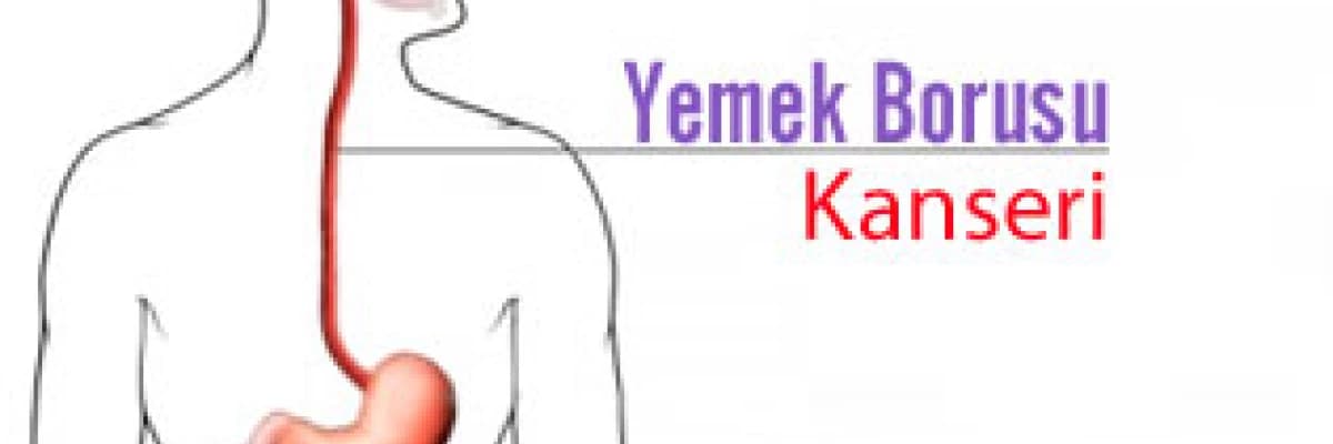 Yemek borusu kanseri hakkında merak edilenler