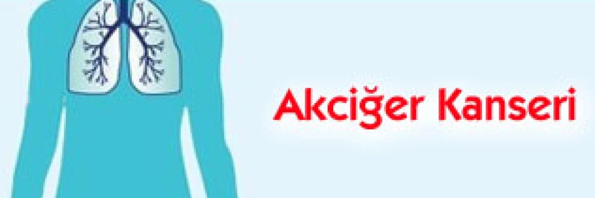 Kanser nedir? Akciğer kanseri nedir?