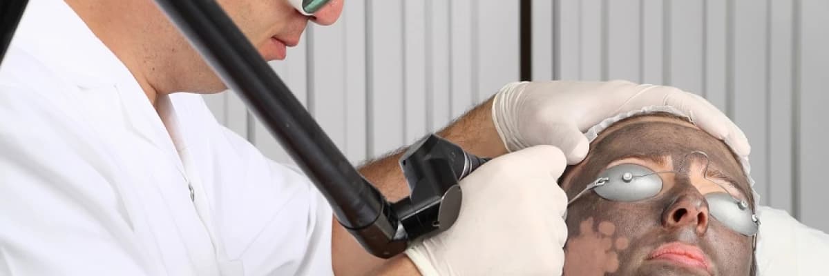 KARBON PEELING Genişlemiş Gözenekler Sarkmış ve Matlaşmış Cildiniz için