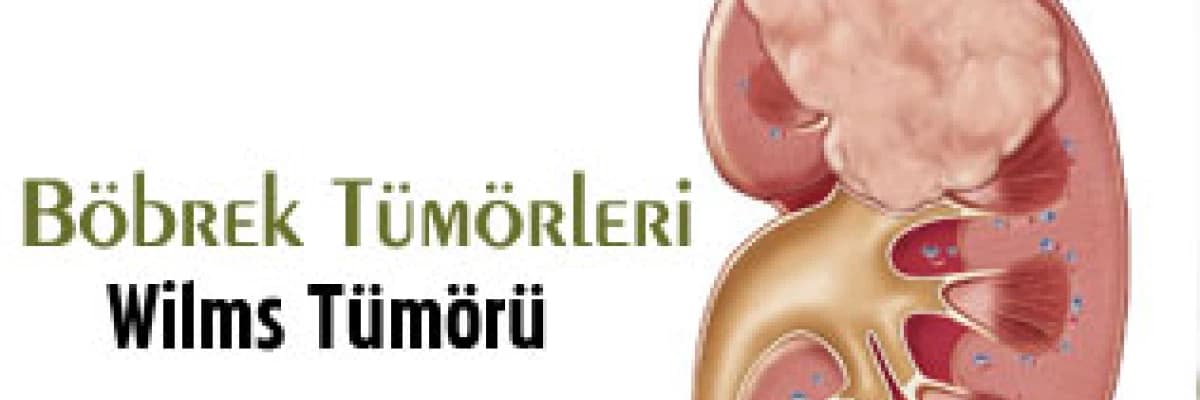 Böbrek Tümörleri - Wilms Tümörü ( Nefroblastom )