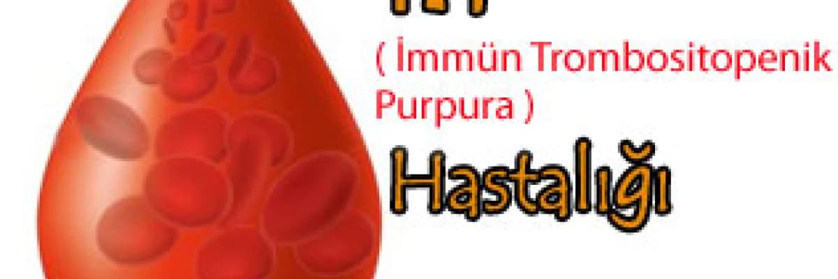 İTP İmmün Trombositopenik Purpura  Hastalığı