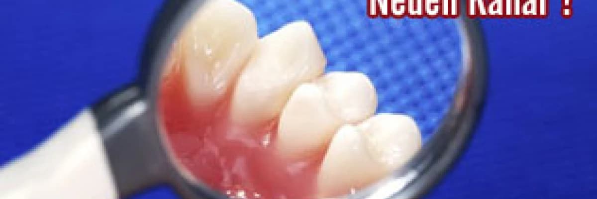 Dişetleri neden kanar ?