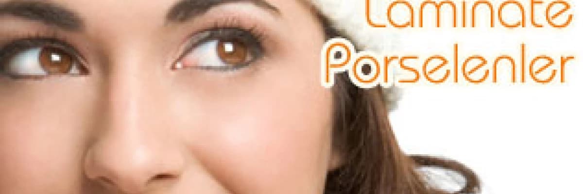 Laminate Porselenler