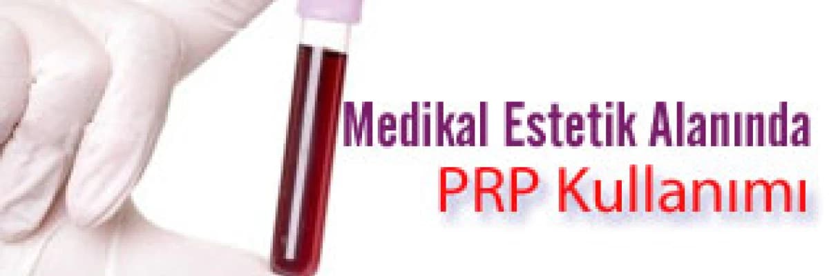 Cilt Gençleştirmede PRP Kullanımı