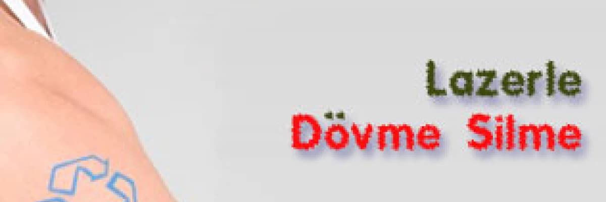 Lazerle dövme silme!
