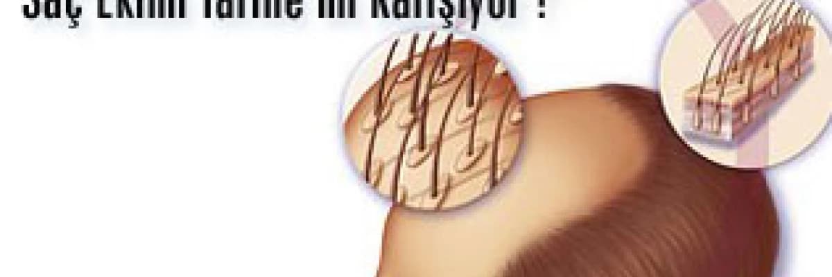 Saç Klonlama: Saç Ekimi Tarihe mi Karışıyor ?