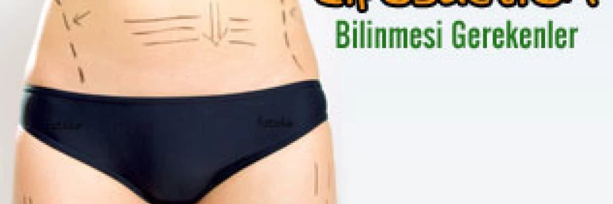 Liposuction hakkında bilinmesi gerekenler