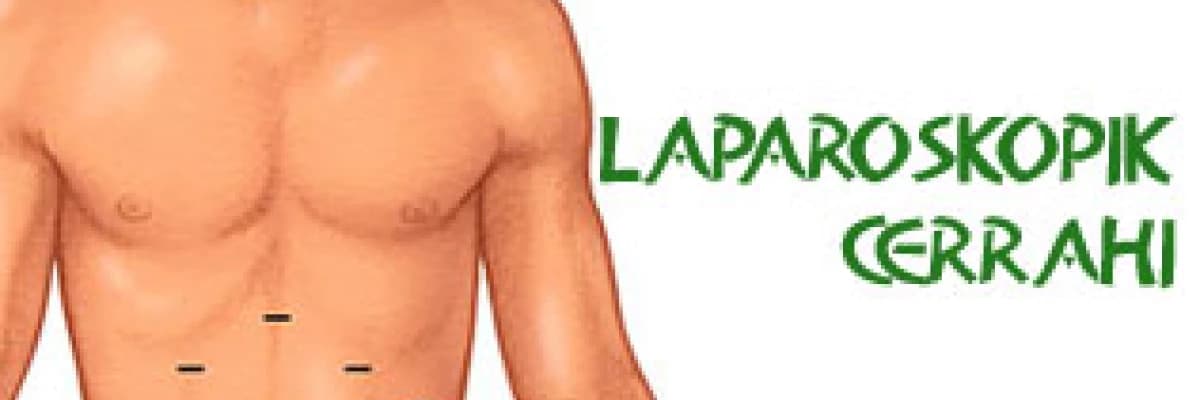 Ürolojide Laparoskopik Cerrahi