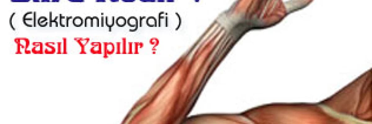 Elektromiyografi (emg) » emg nedir ? nasıl yapılır ?