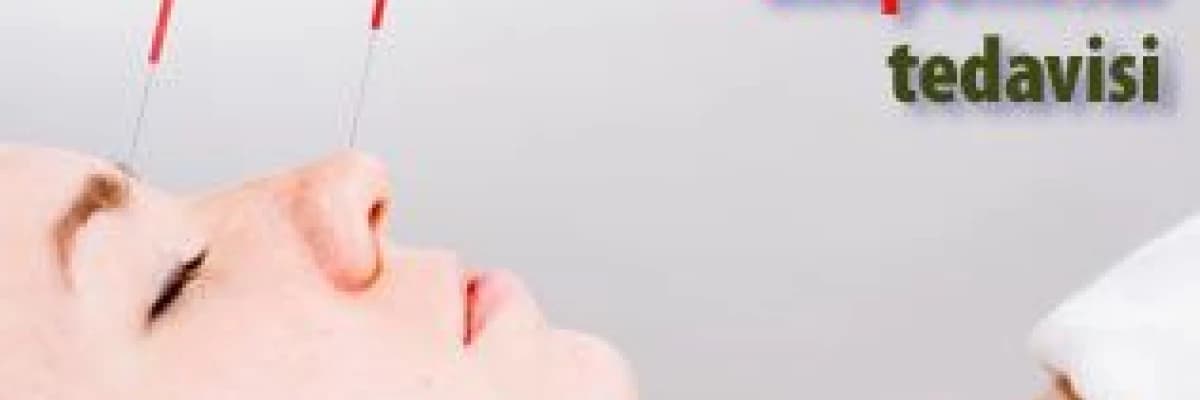 Migrende akupunktur tedavisi