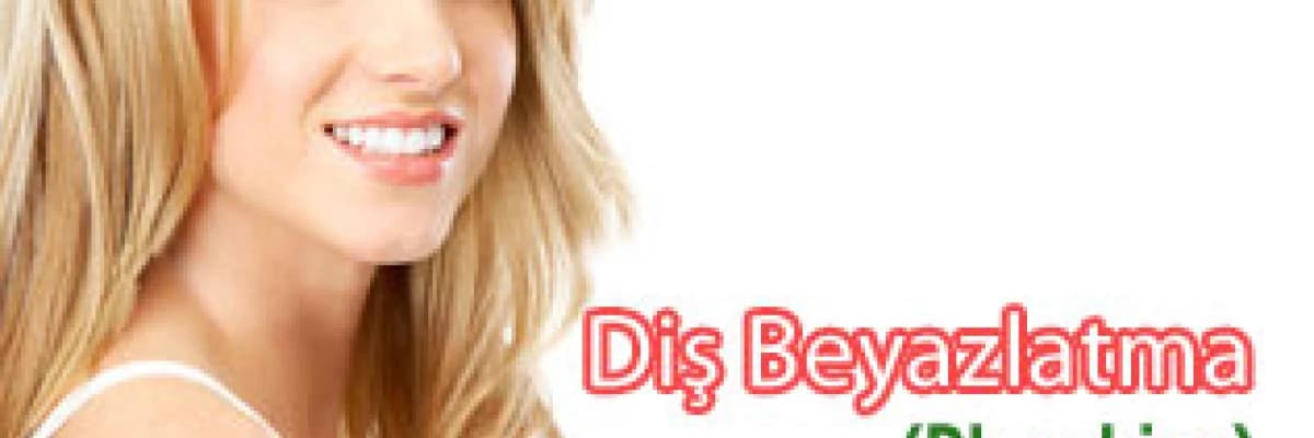 Diş Beyazlatma(Bleaching)