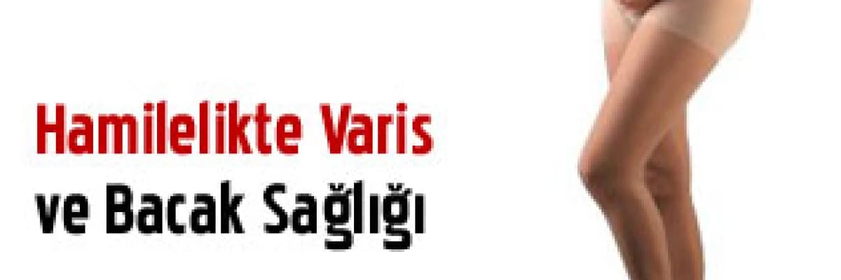 Hamilelikte Varis ve Bacak Sağlığı