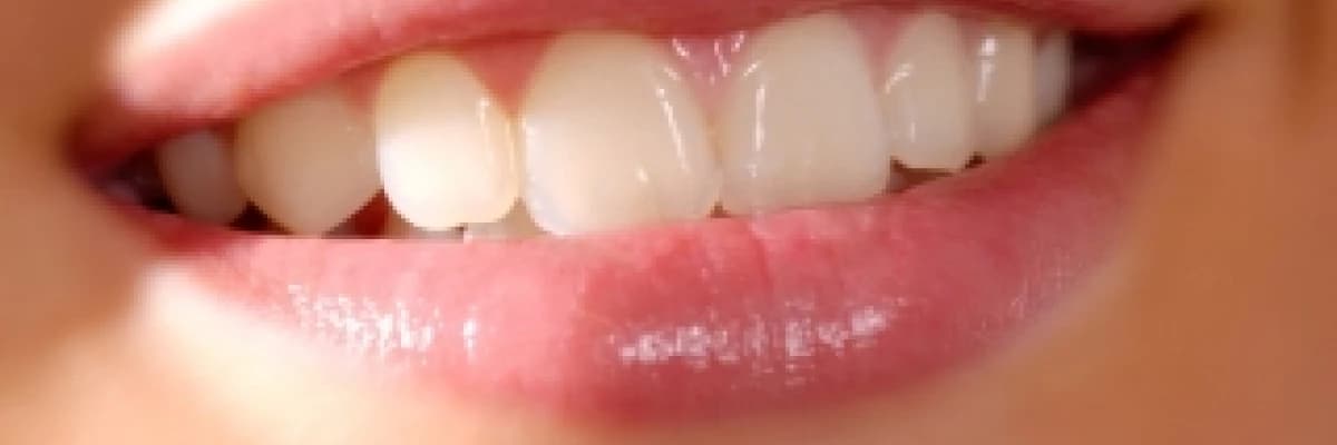 Adeziv sistem ( bonding )