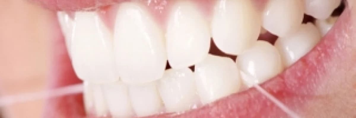 Dişeti hastalıkları "periodontoloji"