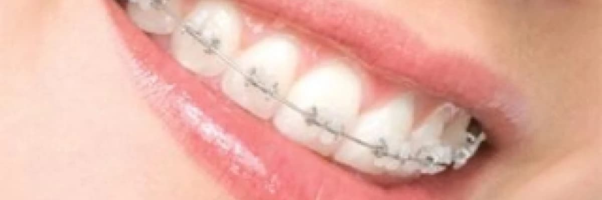 Ortodonti ve çene hastalıkları