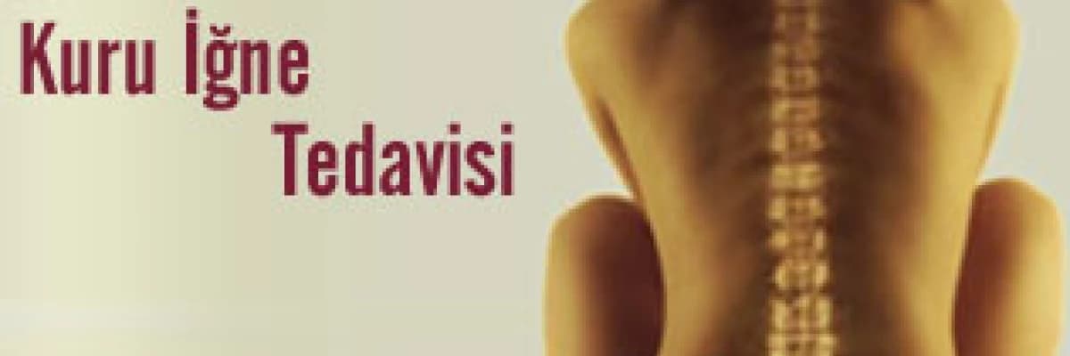 KURU İĞNE TEDAVİSİ 