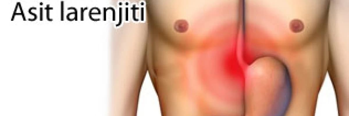 Boğaz reflüsü Asit larenjiti