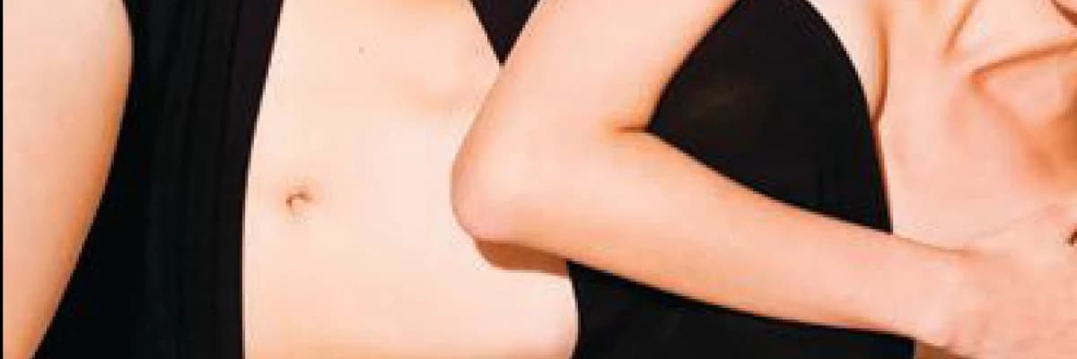 ABDOMİNOPLASTİ( Karın Estetiği) 