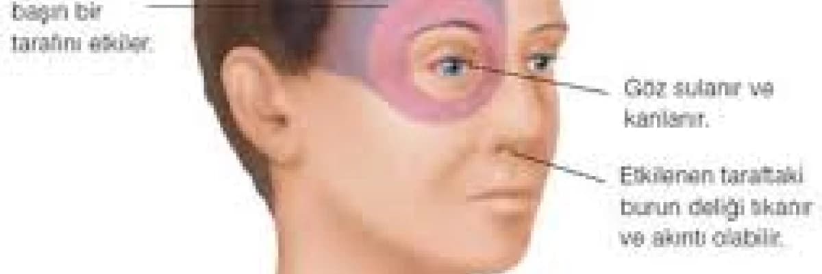 Sinüzit, başağrısı nedenleri ve tedavisi