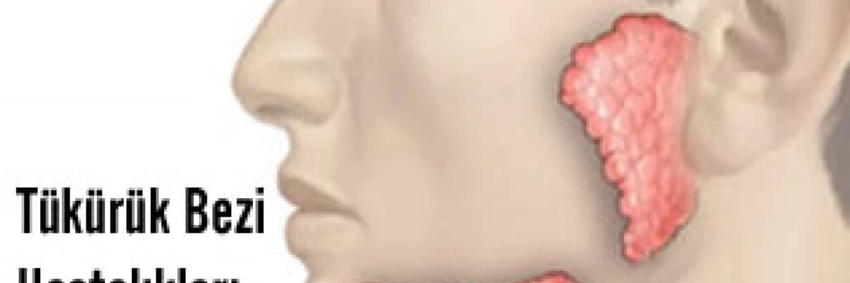 Tükürük bezi hastalıkları