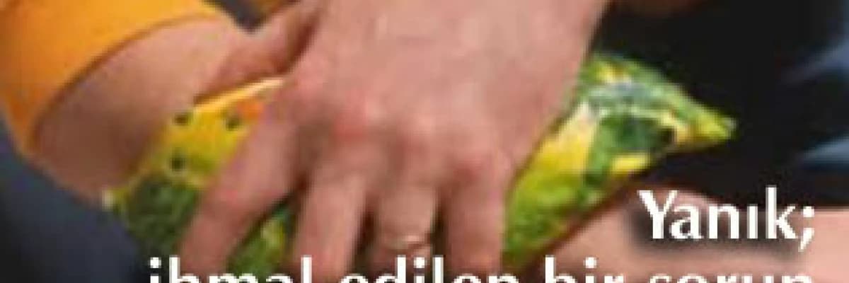 Yanık; ihmal edilen bir sorun