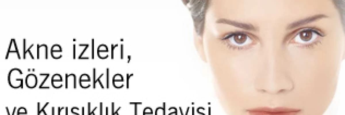 Akne izleri, Gözenekler ve Kırışıklık Tedavisi 