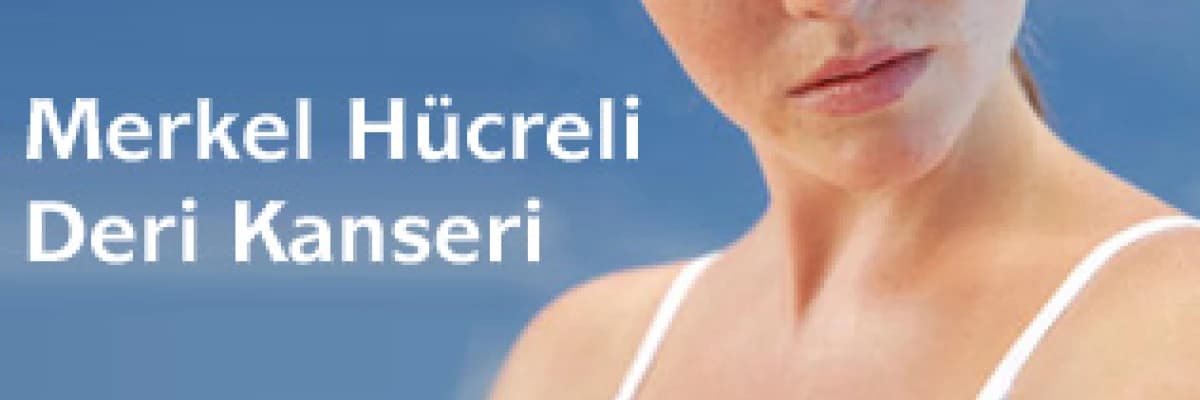 Merkel hücreli deri kanseri ( nöroendokrin deri kanseri) : nadir rastlanan bir  deri kanseri türü.