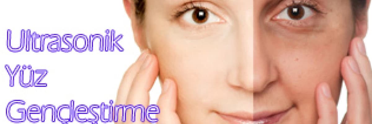 Ultrasonik yüz gençleştirme ( germe ) nedir?