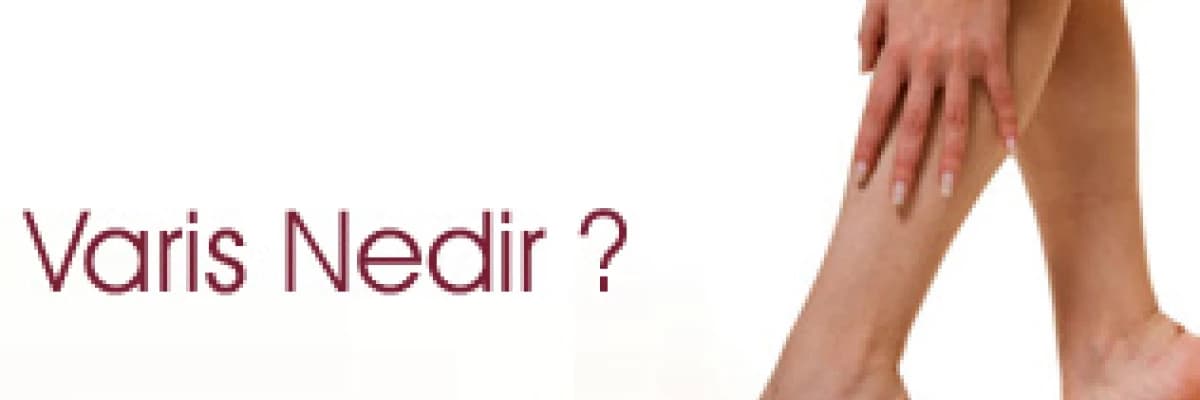 VARİS NEDİR?
