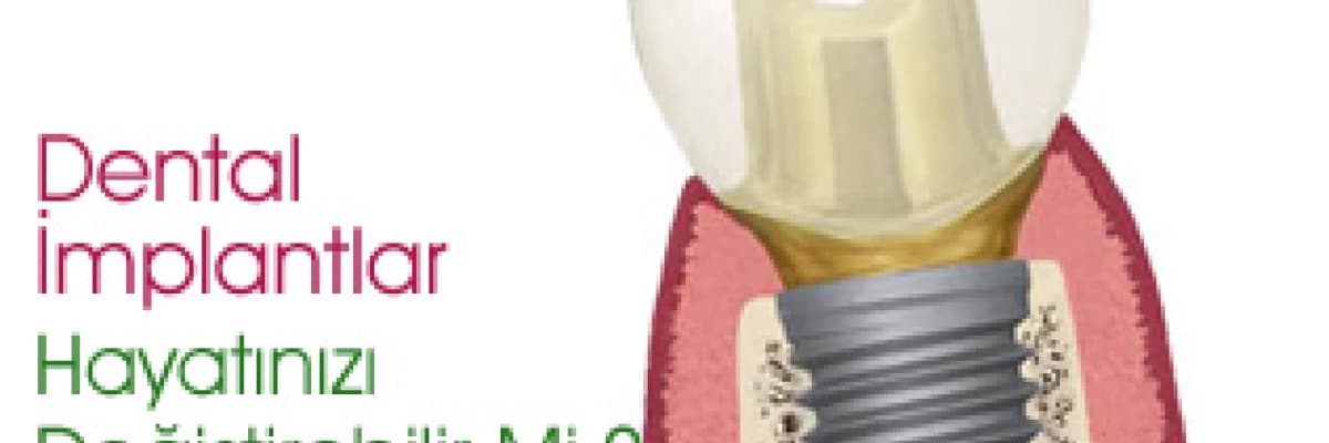 Dental implantlar hayatınızı  değiştirebilir mi?