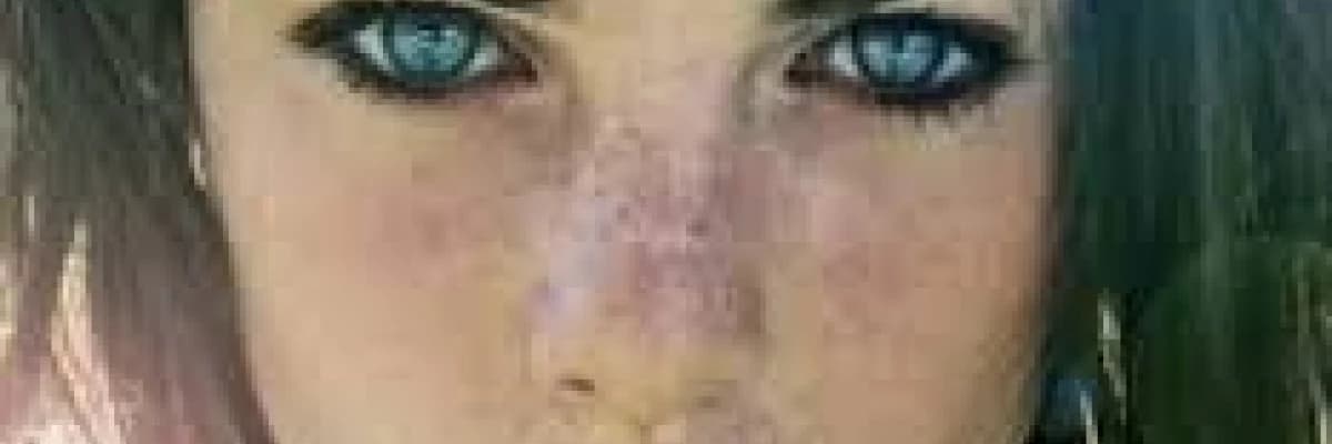 Lekeler ve fraksiyonel lazer