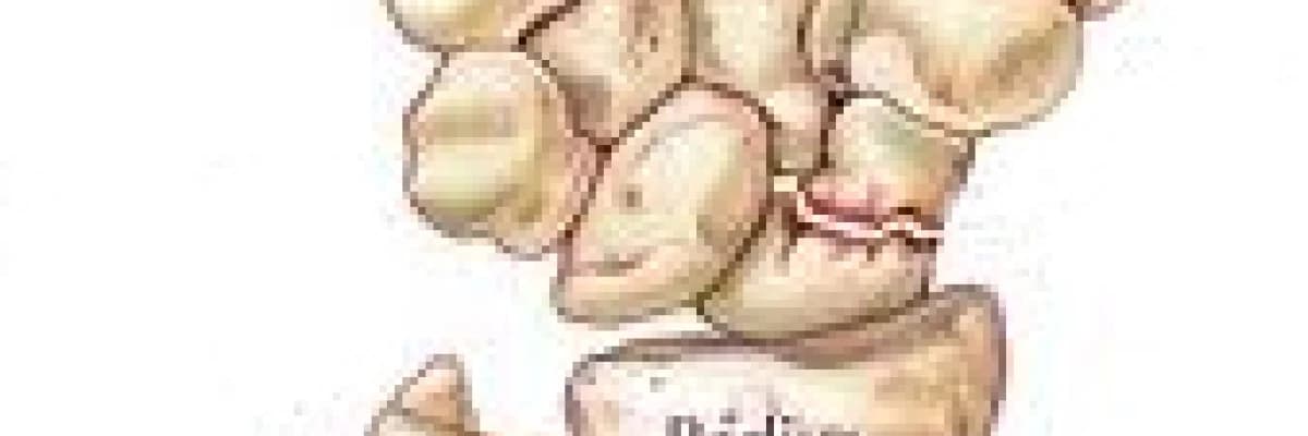 Skafoid kırığı nedir ?