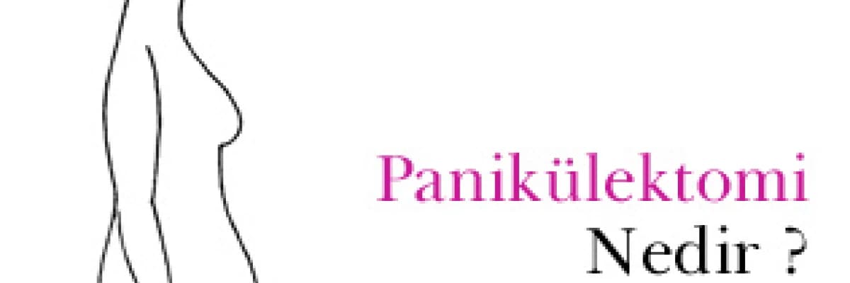 Panikülektomi nedir ? herkes için hafifleme