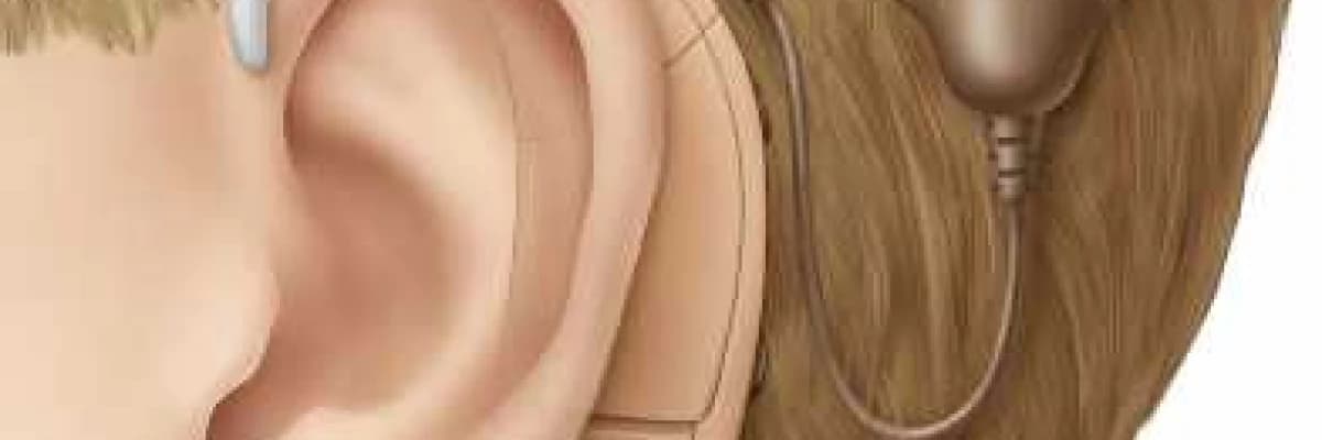 İşitme Engellilerde İşitsel - Sözel Terapi