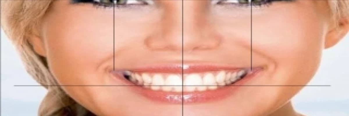 Altın oranla estetik gülüş