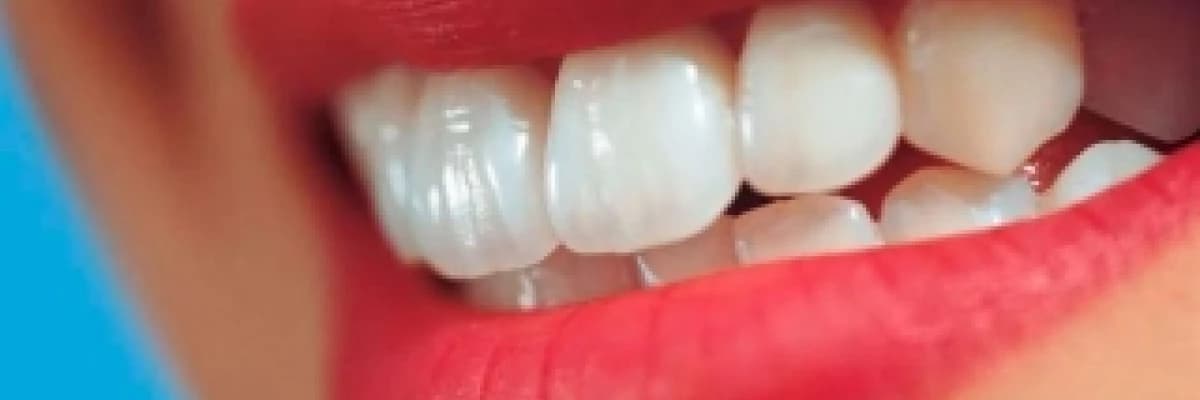 Diş ağartmada (bleaching) güncel bilgiler