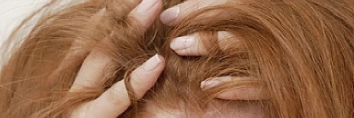 Saç koparma hastalığı (trikotillomani)