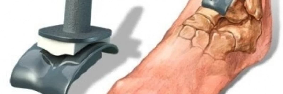 Total ayak bileği protezi